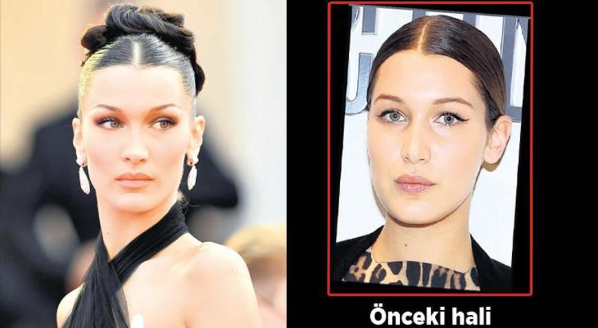 Yanaktan yağ aldırma uyarısı