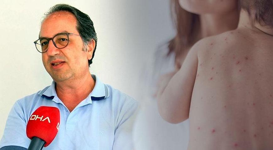 Prof. Dr. Şener: Kızamık  masum bir hastalık değil
