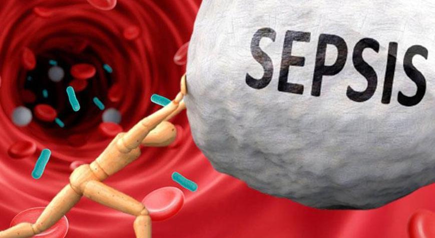 Enfeksiyonların en öldürücüsü Sinsice ilerliyor, tedavi edilmezse kanı zehirliyor