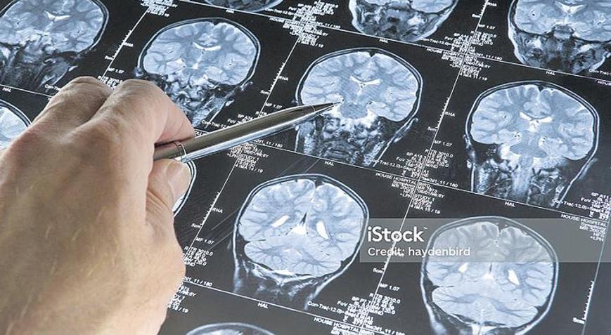 Kovid ‘deli dana’ya yol açıyor mu