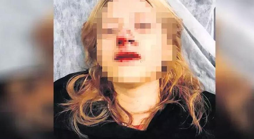 Kaldırım taşıyla dişlerini kırmışlardı: Görmedim dedi