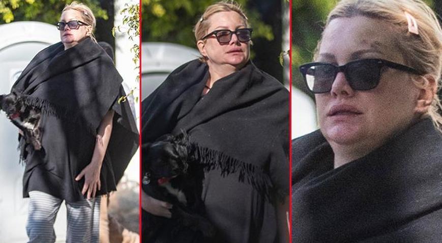 Ne kirasını ödeyebiliyor, ne de yiyecek alabiliyor Ünlü oyuncu dibe vurdu