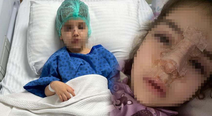 Özel kreşte 4 yaşındaki kızın burnu kırıldı Ailelerden şoke eden iddia