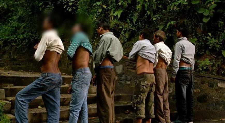 Bir köyü tek böbrekli bırakan deprem Ölümden beter duruma düştük