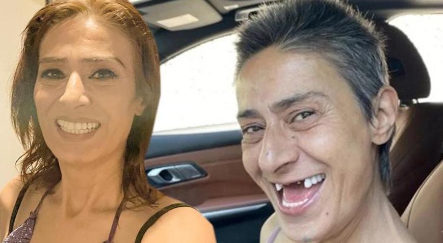 Yıldız Tilbeden dişsiz fotoğraflar