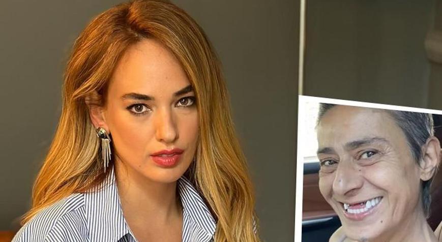 Seda Bakandan Yıldız Tilbeye destek Dişsiz halini paylaştı