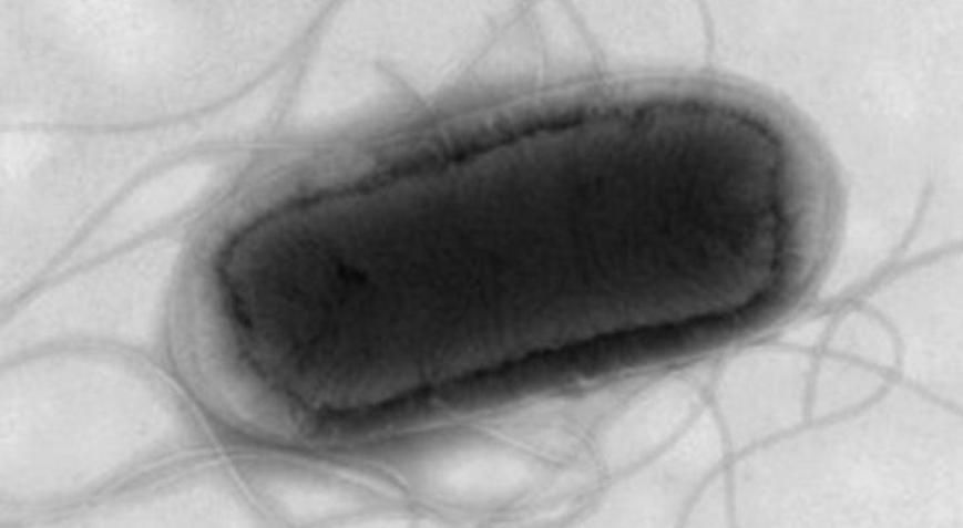 İngiltere’de korkutan koli basili salgını: En az 113 vaka