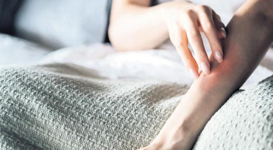 Egzamanın ilacı doğal değil doğru ürünler