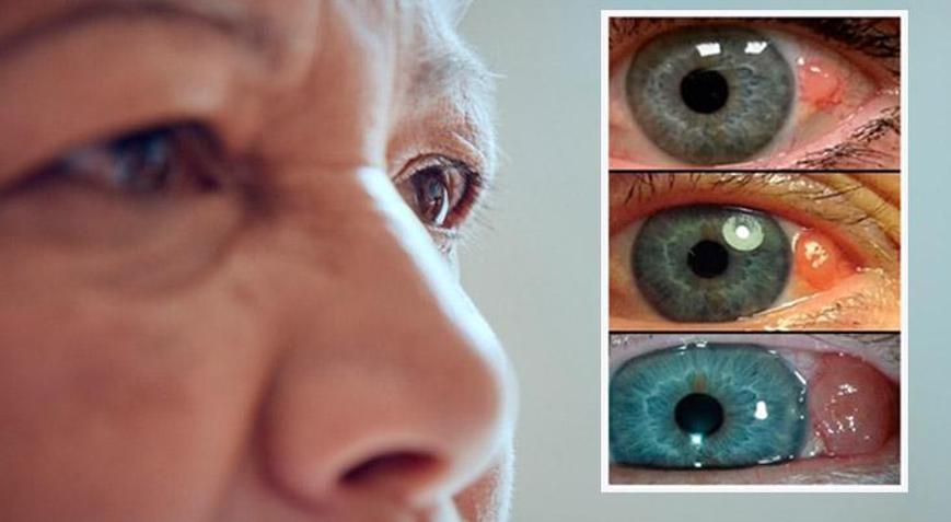 Basit bir apse sandı, gözünden oldu Her gün daha da büyüyor: Rengine aldanmayın