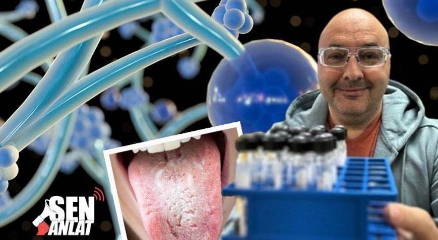 Çaresiz kaldı, hastalığını ürettiği bakteriyle iyileştirdi Eşimizi ter kokusuna göre seçeriz