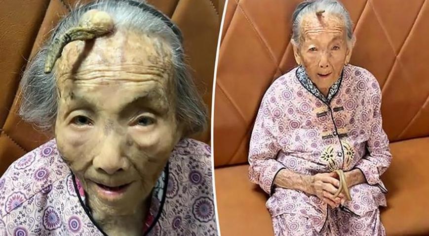 Dünyanın konuştuğu kadın 107 yaşında kafasında boynuz çıktı
