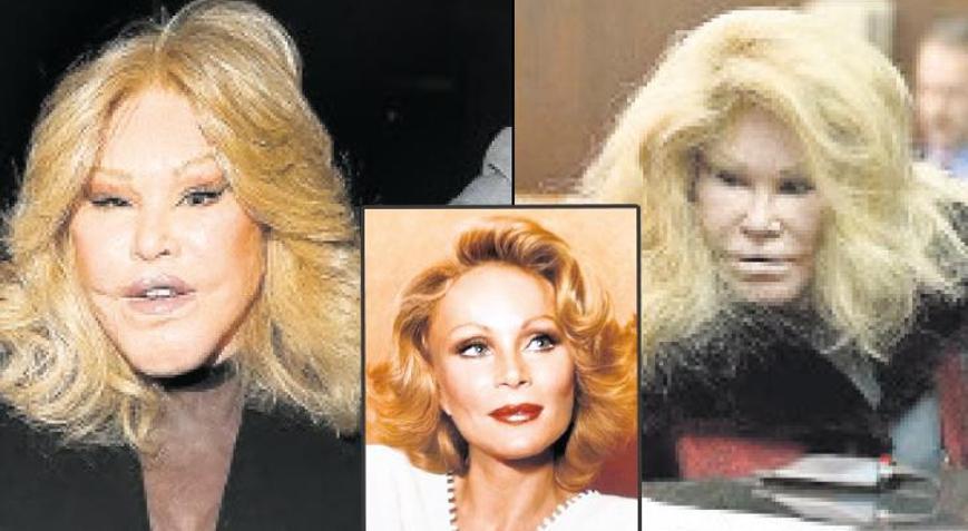 Doğallığın ölüm ilanı Eşi yüzünden bu hale geldi