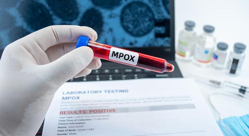 Nijeryada, M çiçeği salgınına karşı aşılama kampanyası başlatıldı