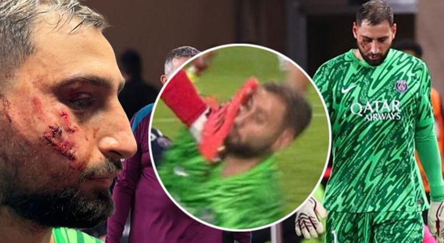 Monaco - PSG maçında korkunç sakatlık Sarı kart bile çıkmadı