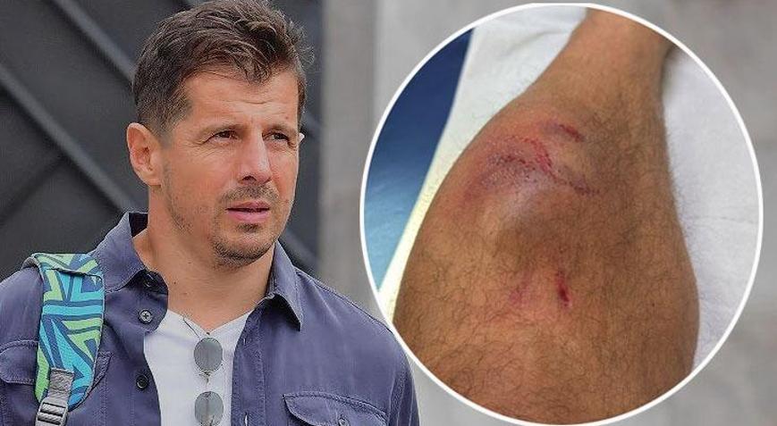 Emre Belözoğlu kaza geçirmişti Bacağının son hali şok etti