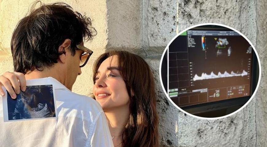 Doğuma günler kaldı Cansel Elçin ile Zeynep Tuğçe Bayat, bebekleri için sosyal medya hesabı açtı