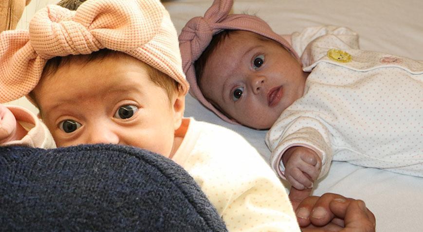 Prematüre doğdu, 1 haftalıkken teşhis kondu Miray bebeğin 1 milyon 870 bin dolara ihtiyacı var