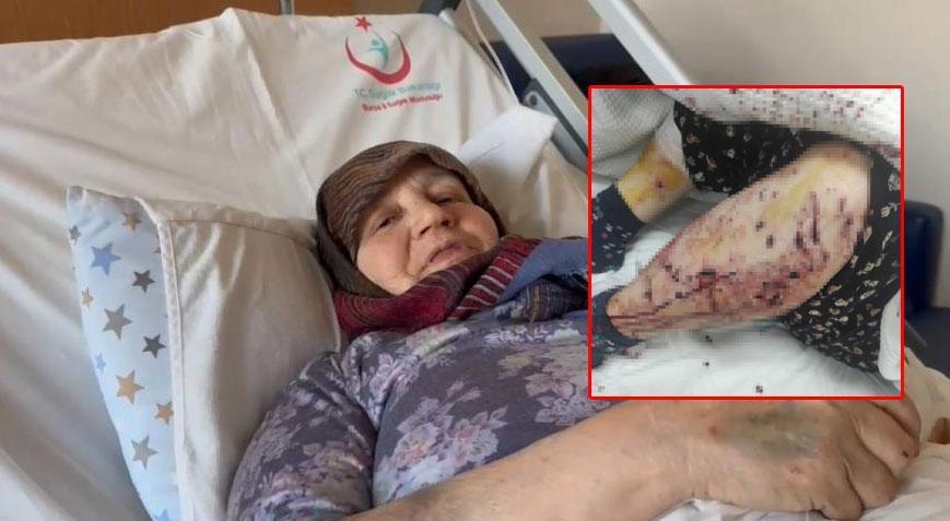 7 sahipsiz köpek 66 yaşındaki kadına dehşeti yaşattı