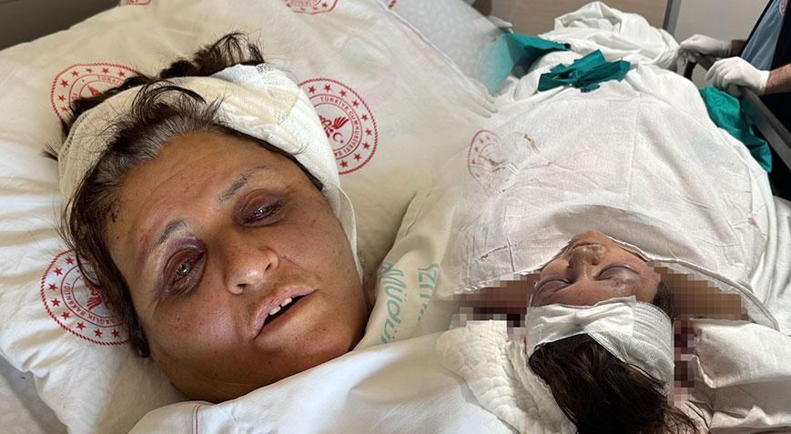 Yufka yüzünden kaynanasını tuğlayla dövdü Gelin dehşetinde yeni gelişme