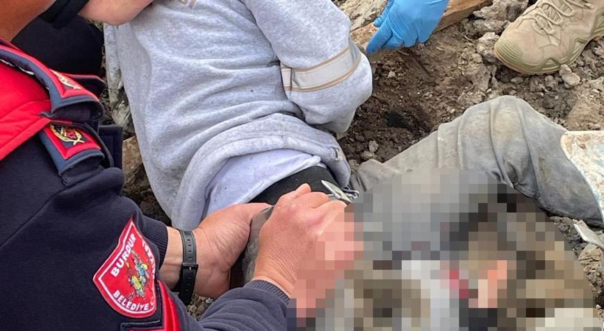 Bacağını çapa makinesine kaptırdı