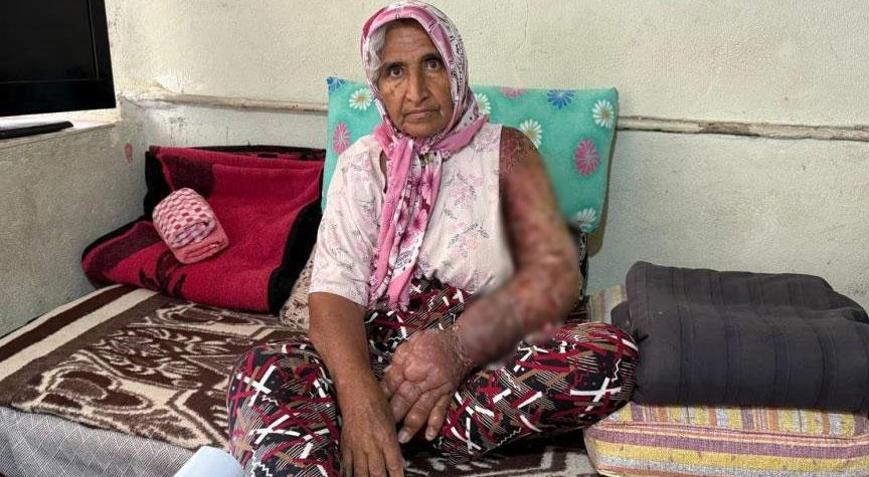 Her şey 8 yıl önce başladı Kolu şişti, vücuduna kadar yayıldı