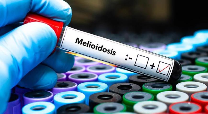 Avustralyada melioidoz salgını Can kaybı 31e çıktı