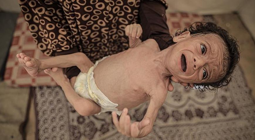 Gazzede anneler sütten kesildi, bebekler ölümün eşiğinde: Ne mama var ne temiz su
