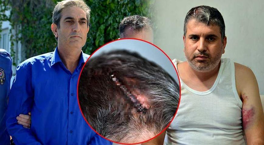 Miras yüzünden yeğenini beyzbol sopasıyla darbeden dayıdan şok sözler: Beni tahrik etti, dayanamadım