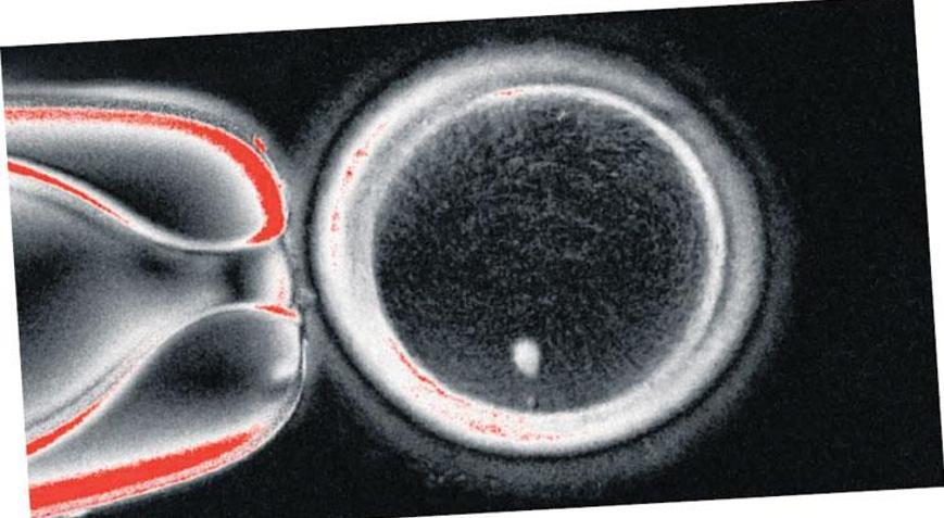 Cilt hücresiyle insan üretimi