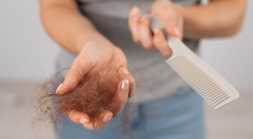 Dökülen saçların ilacı Oluk oluk dökülmeyi 1 haftada kesiyor