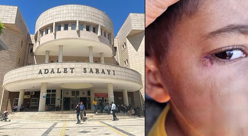 İlkokul öğrencisinin yüzünde sigara söndürdü Temizlik görevlisi tutuklandı