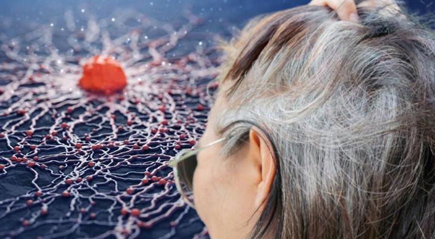 Beyaz saçların bilinmeyen sırrı Yaşlılık değilmiş: Hücreler kanserle mi savaşıyor