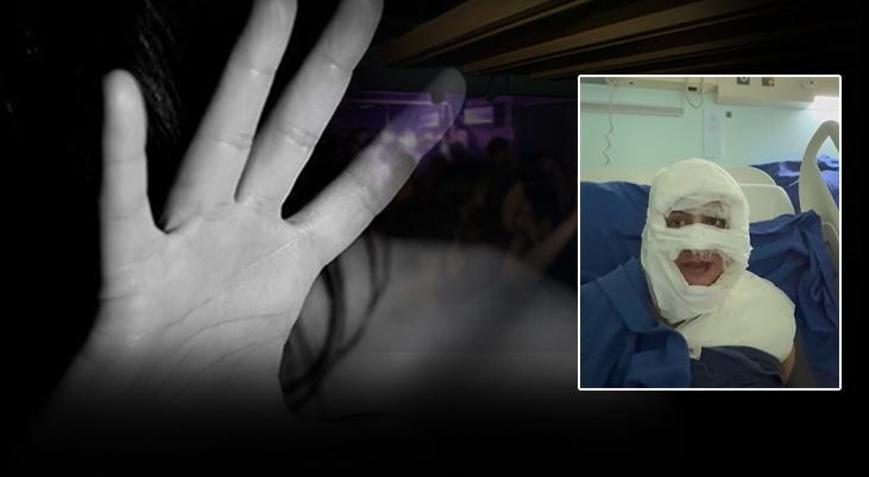 Kadıköyde eğlence mekanında dehşet: Genç kadını kolonya döküp yaktı