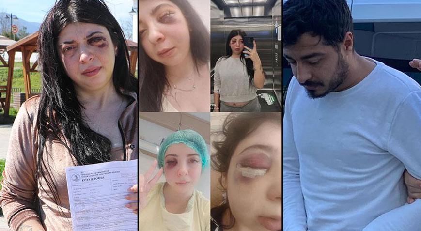 Sokak ortasında darp ve taciz Damla’ya dehşeti yaşatan cani ile ilgili karar