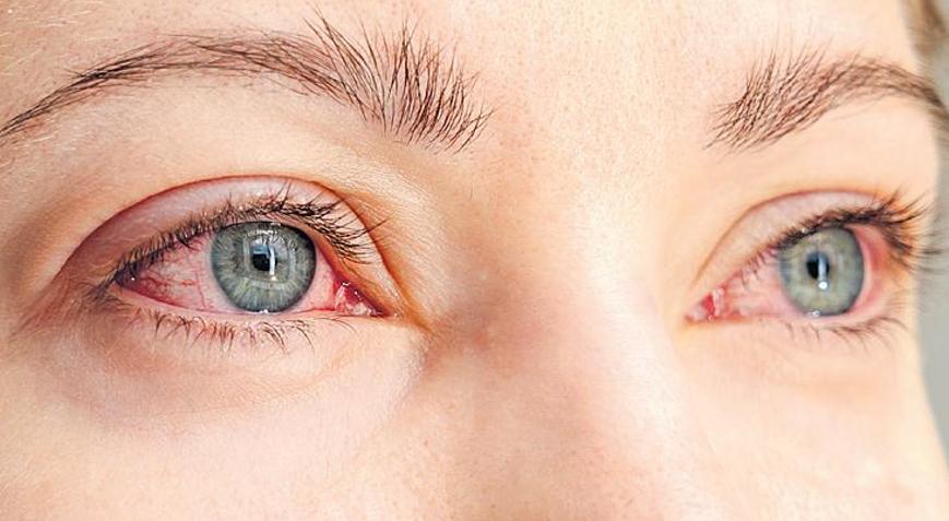 Diyabet gözlerinizi sessizce tehdit ediyor