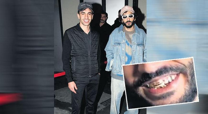 Altın dişleri göz aldı