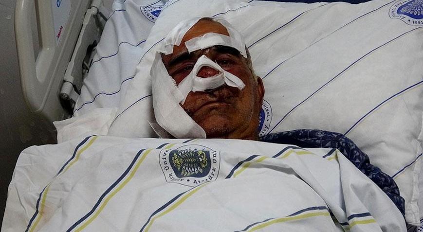 Kentte 5inci ayı dehşeti Hayvan otlatırken saldırdı: Yüzünde çok büyük kesiler, yırtıklar vardı