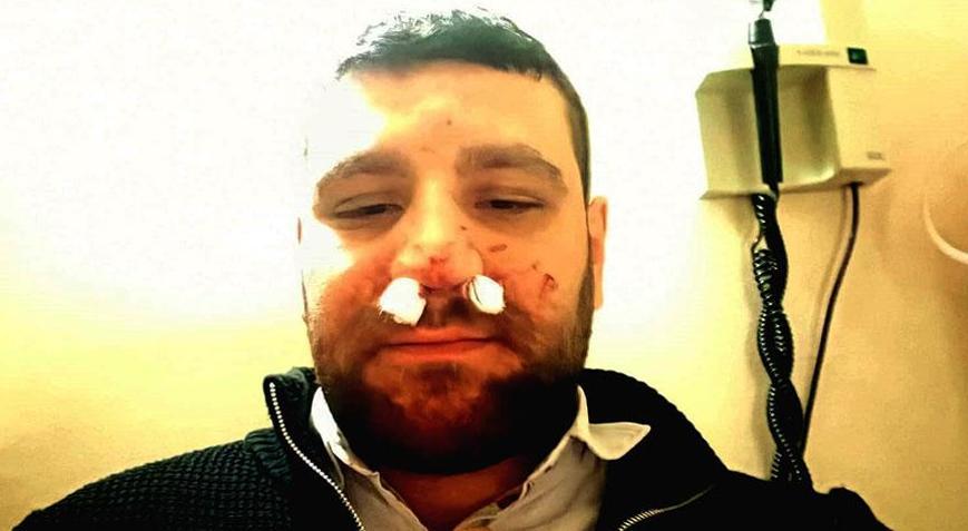 Trafikte yol verme dehşeti Avukatın burnu kırıldı: Elindeki cisimle vurdu, kafa attı