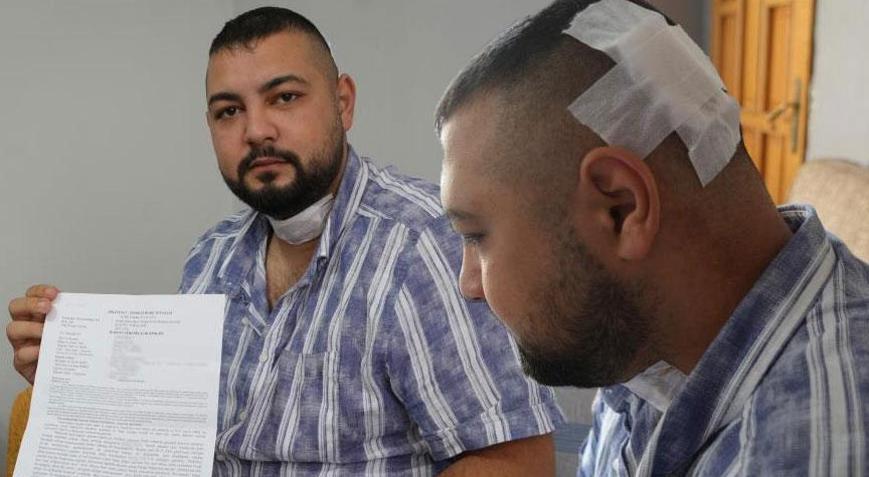 Amcası tarafından boğazından ve kafasında bıçaklandı Kabusu bitmedi: Belki de yarın tabanca ile sıkacak