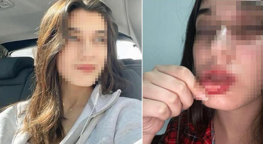 Sosyal medyadan paylaştı, dehşeti anlattı: Tek başıma tuzağa düşürüp bana saldırdı