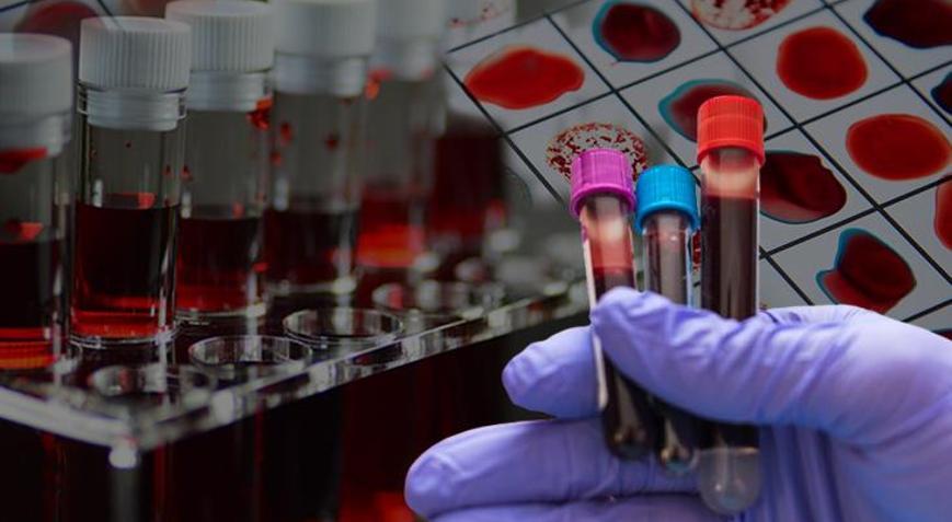 Dünyada sadece 50 kişide var Altın kan laboratuvarda üretilebilecek mi