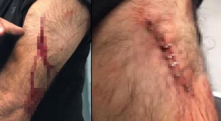 Şanlıurfada dehşet Öğretmene sokakta jiletli saldırı