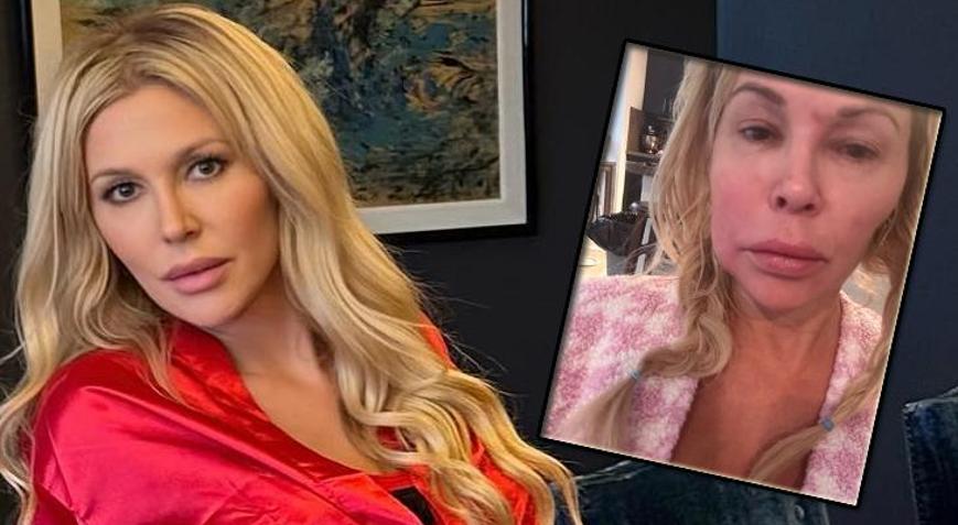 Yüzü eriyordu Gizemli hastalığın sırrı ortaya çıktı