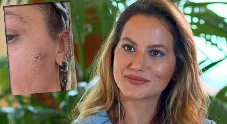 Yıldız Asyalıdan şoke eden paylaşım Kocam tarafından darp edildim