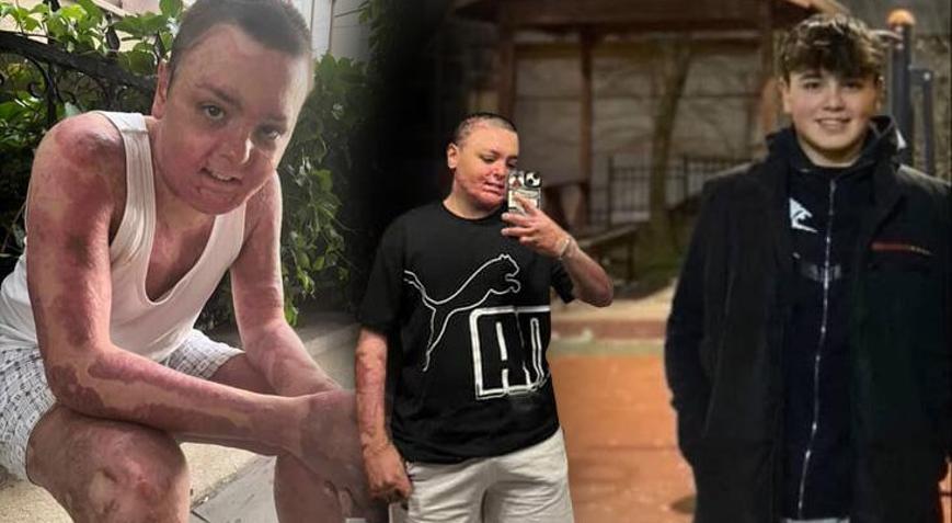 Felaketten mucizeye: 6 ay sonra çok güzel fotoğraflarla mutluluğunu paylaşacak