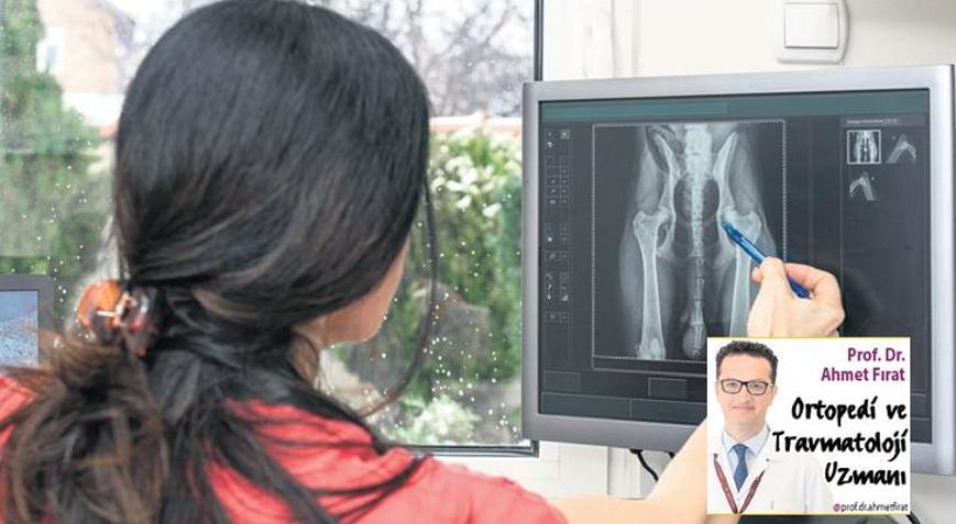 Doğuştan gelen erişkin kalça displazisi