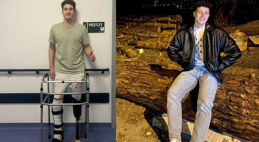 Bacağını kaybeden üniversiteli genç 7 ay sonra ayağa kalktı: Milli takımda olmayı çok isterim