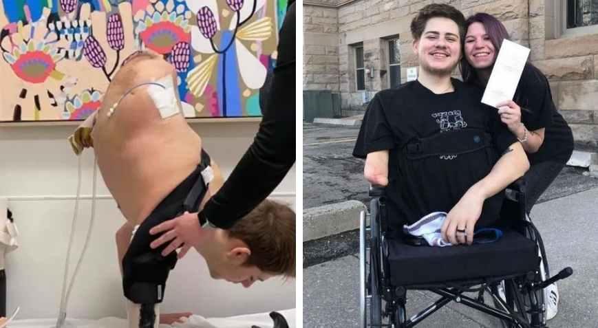 Mucize hayatta kalış: İş kazasında vücudunun yarısını kaybetti Sözleri ilham oldu