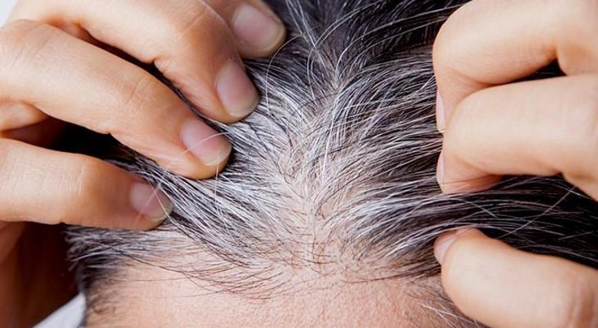Saçlar neden beyazlar, geri döndürmek mümkün mü Bilim insanları gerçeği açıkladı