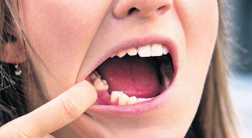 Yaşam süresi dişlerde gizli